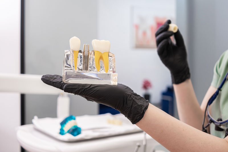 A dental professional in black gloves holds a clear model showing a dental implant with the post and crown.